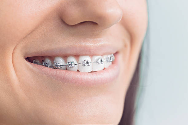 Best Teeth Whitening  in Rossville, KS